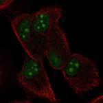 WBP5 Polyclonal Antibody