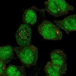 FANCE Polyclonal Antibody