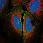 Connexin 45 Polyclonal Antibody