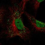 GIMAP2 Polyclonal Antibody