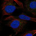 SGMS2 Polyclonal Antibody