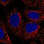 Tenascin X Antibody in Immunocytochemistry (ICC/IF)