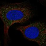 SPCS2 Polyclonal Antibody