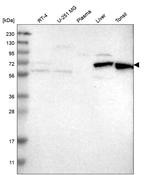 HDAC10 Antibody in Western Blot (WB)