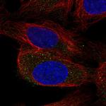 ENTHD2 Antibody in Immunocytochemistry (ICC/IF)