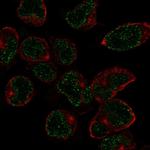 Nkx2.6 Polyclonal Antibody