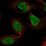 ZNF496 Polyclonal Antibody