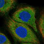 LILRB3 Polyclonal Antibody