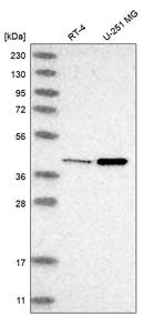 NME7 Antibody in Western Blot (WB)