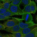 KDF1 Polyclonal Antibody