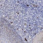 IGLV6-57 Antibody in Immunohistochemistry (Paraffin) (IHC (P))