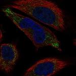 LHFPL5 Polyclonal Antibody