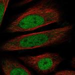 RNF20 Polyclonal Antibody