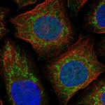 NDUFAF4 Polyclonal Antibody