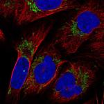 KLHL29 Polyclonal Antibody