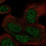 DHX36 Polyclonal Antibody