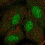 PYDC2 Polyclonal Antibody