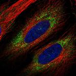 VWDE Polyclonal Antibody