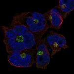 ST8SIA4 Polyclonal Antibody