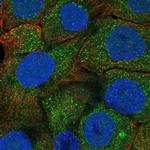 Profilin 3 Antibody in Immunocytochemistry (ICC/IF)