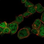 ZNF302 Polyclonal Antibody