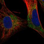 VGLUT3 Polyclonal Antibody