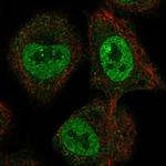 HELB Polyclonal Antibody