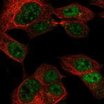 CCDC169 Polyclonal Antibody