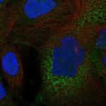 C11orf16 Polyclonal Antibody