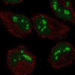 ZCCHC2 Antibody in Immunocytochemistry (ICC/IF)