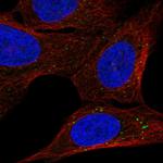 BBS2 Polyclonal Antibody