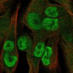 KCTD15 Polyclonal Antibody