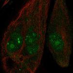 ANKRD30B Polyclonal Antibody