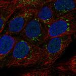 TMPRSS11E Polyclonal Antibody