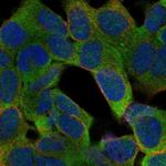 PTGDR Polyclonal Antibody