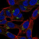 LRRTM1 Polyclonal Antibody