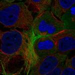 GPR148 Polyclonal Antibody