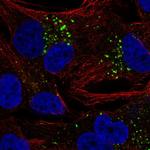 EMP1 Polyclonal Antibody