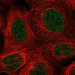 MSANTD1 Polyclonal Antibody