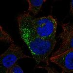 BMP-8B Polyclonal Antibody