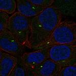 PLEKHG7 Polyclonal Antibody