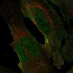 CHRNA2 Polyclonal Antibody