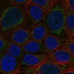 CYP11B2 Polyclonal Antibody