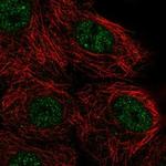 NUDT17 Polyclonal Antibody