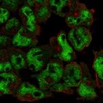 UBASH3A Polyclonal Antibody