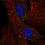 TCTEX1D4 Polyclonal Antibody