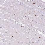 ADSSL1 Polyclonal Antibody