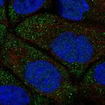 SRRM5 Polyclonal Antibody