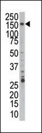 PRPF4B Antibody in Western Blot (WB)