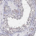 MUM1 Polyclonal Antibody